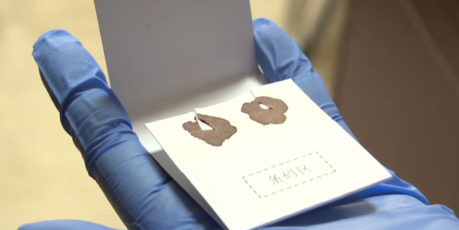 嘉兴医院做亲子鉴定生物样本有些什么,