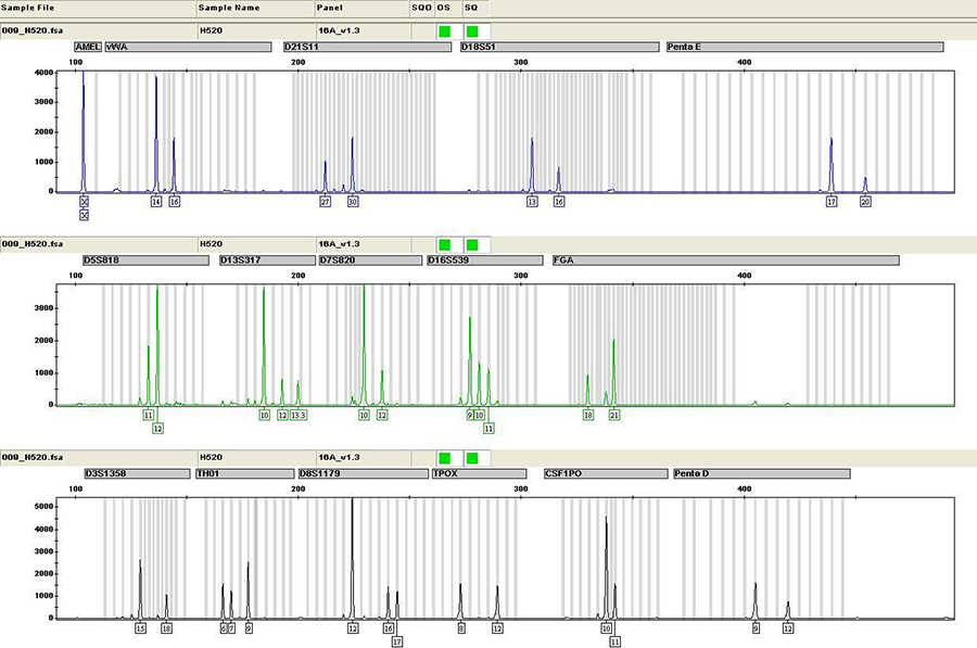嘉兴私密亲子鉴定费用多少钱,嘉兴隐私亲子鉴定办理的流程